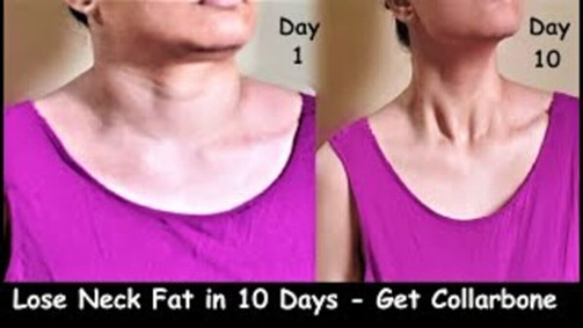 How to get rid of neck fat naturally