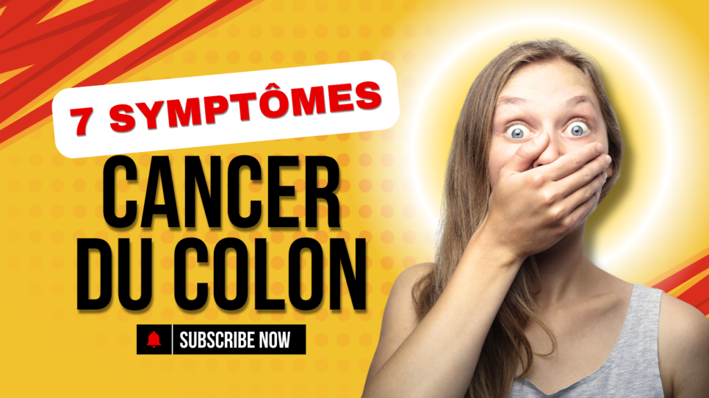 cancer colon